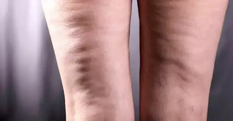 48d65296-36f7-4204-919c-2a04681d224c.jpeg